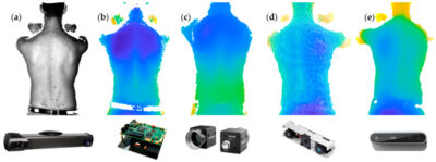 3D back shape captures from Photoneo MotionCam-3D and other 3D vision technologies